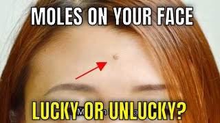 Meanings Of Moles On Different Parts Of The Face - Are They Lucky Or Unlucky? Kahulugan Ng Mga Nunal