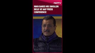 Delhi Polls | Arvind Kejriwal's Big Promise As Man Bares His Swollen Belly At AAP Press Conference