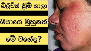 whitening creams sinhala | bleaching asadana