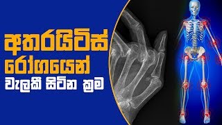 අතරයිටිස් රෝගයෙන් වැලකී සිටින ක්‍රම | 10 - 08 - 2018 | SIYATHA TV