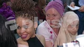 International Albinism Awareness Day : Albinos Still Standing Strong