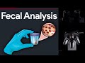 Fecalysis- MICROSCOPIC STOOL ANALYSIS STEP BY STEP GUIDE| |MEDICAL LABORATORY SCIENCE