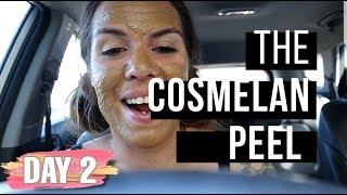 My Cosmelan Peel | Day 2