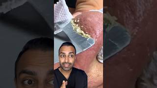 Do Ultrasonic Face Scrubbers ACTUALLY Work? Dr Somji explains