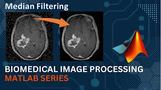 Median Filter || MATLAB Code Implementation || Medical Image Processing |Computer Vision