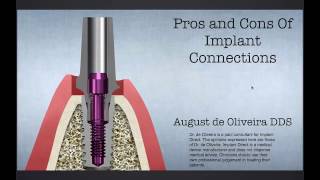 Dental Education: The Evolution of Implant Connections Feb 15, 2017
