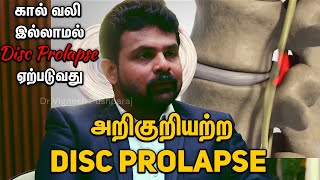 Disc Prolapse கால் வலி இல்லாமல்  Disc Prolapse ஏற்படுவது அறிகுறியற்ற வட்டு ப்ரோலாப்ஸ் எனப்படும்