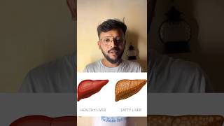 Fatty liver മാരൻ ഇതൊന്നു ചെയ്തു നോക്കു വെറുതെ ഇരിക്കുമ്പോ