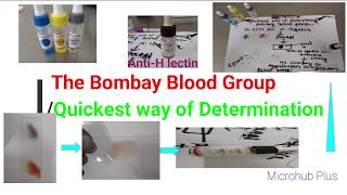 The Bombay Blood group quickest way of determination