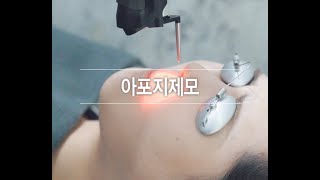 아포지 플러스 레이저 제모