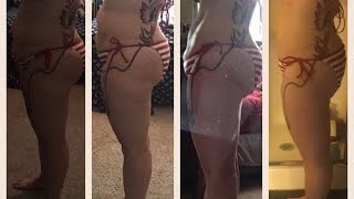 Hypothyroidism case study 40 pound weight loss over 6 months with before/after pictures