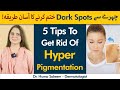 5 Tips To Remove Dark Spots | How To Get Rid Of Hyperpigmentation? | Dark Spots Removal