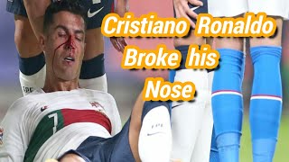 Cristiano Ronaldo's Broken Nose Injury | Czech Republic Vs Portugal 24-09-2022