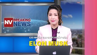 Cái nhún vai cười khẩy của Elon Musk