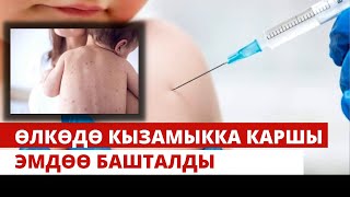 Кыргызстанда кызамыкка каршы эмдөө кампаниясы старт алды