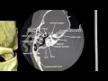 Facial Nerve Segments