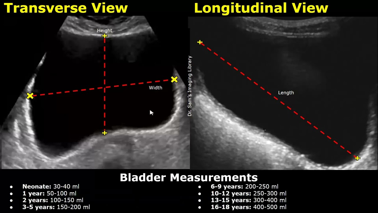 How To Measure Bladder On Ultrasound | Bladder Length, Width, Height ...