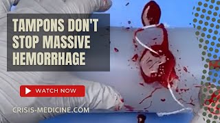 Tampons don't stop massive hemorrhage