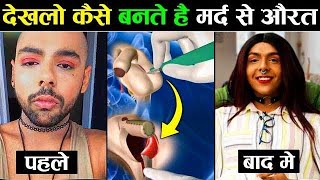 लड़का से लड़की बनने की सर्जरी कैसे की जाती है !! Male To Female Gender Change Surgery Process