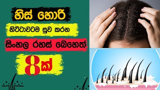 හිස් හොරි සදහටම නැති කරන මැජික් බෙහෙත් 8ක් -hishori walata beheth home remedies for dandruff sinhala