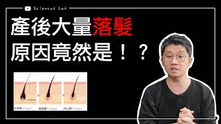 為什麼女生 生產後會大量落髮？ by 科學剪髮 實驗室 Sciencut Lab CC字幕