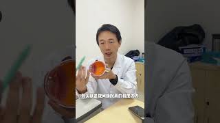 网脱的不同阶段   都有什么表现  怎么治疗 硬核健康科普行动  眼科  视网膜脱落  抖出健康知识宝藏