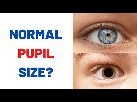 Why are my pupils naturally big?