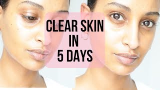 CLEAR GLOWING SKIN w/ Sweet Almond Oil| Segen Misghina