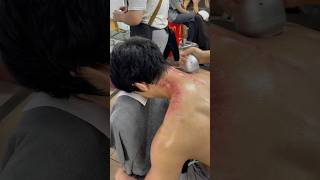 Have you ever seen gua sha?