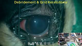 Debridement \u0026 Grid Keratotomy 각막궤양수술