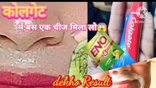 Stop shaving👉 ये मामूली सी चीज दाढ़ी ,मूंछ को करेगा झट से साफ हो जाओगे 😱 Facial Hair Remove