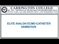 ELITE AVALON ECMO CATHETER