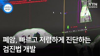 폐암, 빠르고 저렴하게 진단하는 검진법 개발 / YTN 사이언스