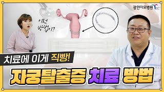 자궁탈출증 어떻게 치료해야 하나요?