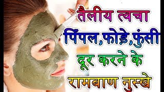 तैलीय त्वचा, पिंपल,फोड़े,फुंसी दूर करने के रामबाण नुस्खे oily skin ka ilaj in hindi