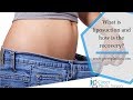 Liposuction Recovery