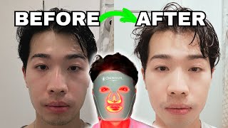 I used Omnilux Men for 150 Days | Does Red Light Therapy WORK?