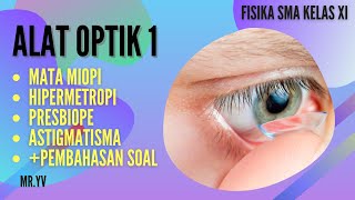 MATA & CACAT MATA MIOPI, HIPERMETROPI, PRESBIOPI & ASTIGMATISMA| MATERI ALAT OPTIK | KELAS XI