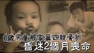 6歲男童被家暴四肢骨折　昏迷2個月喪命 | 台灣蘋果日報