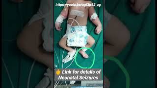 Neonatal Clonic Seizure