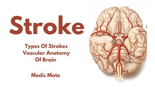 Stroke | Introduction | Types of Strokes | Vascular Anatomy of Brain | Urdu | Hindi