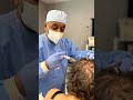 prp treatment at zinnia aesthetics