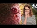 What Is A Tumor? What Is A Tumor?