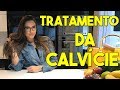 TRATAMENTO DA CALVÍCIE | Alopecia Androgenética #51 TRATAMENTO DA CALVÍCIE | Alopecia Androgenética #51