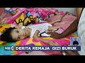 Remaja Penderita Gizi Buruk di Indramayu Hanya Terbaring Lemah di Rumahnya #LintasiNewsSiang 09/11