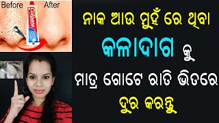 ଗୋଟେ ରାତି ଭିତରେ ମୁହଁର ସବୁ କଳା ଦାଗକୁ ଦୁର କରନ୍ତୁ | Remove Blackheads Permanently | Priyanka's Tips