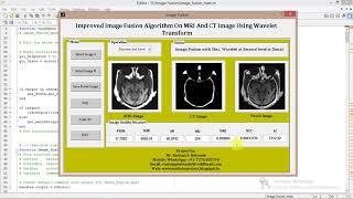 Matlab Code for Image Fusion using Image Processing