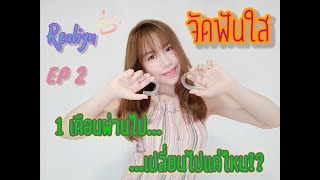 รีวิวจัดฟันใส EP.2 : 1 เดือนผ่านไป... มีอะไรเปลี่ยนบ้าง (+รับ tray ชุดที่ 2) #Realign #รีวิวจัดฟันใส