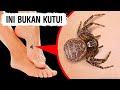 Jika Kamu Melihat Serangga Ini, Jangan Dipencet!