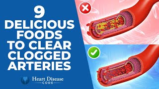 9 Delicious Foods To Clear Clogged Arteries
